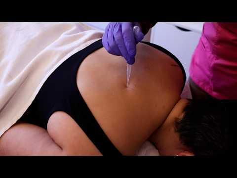ASMR | Allergy Test and Skin Treatment Exam for Sleep
