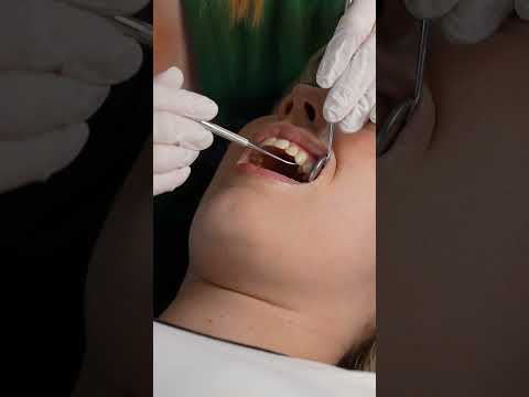 Daily Short(Sorry for Messed up Audio!) Dental Exam  #asmr  #asmrmedical #asmrdentist #asmrteeth