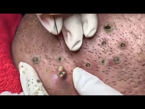 ‎تلميع وتنظيف الجلد الطبيعي المدور