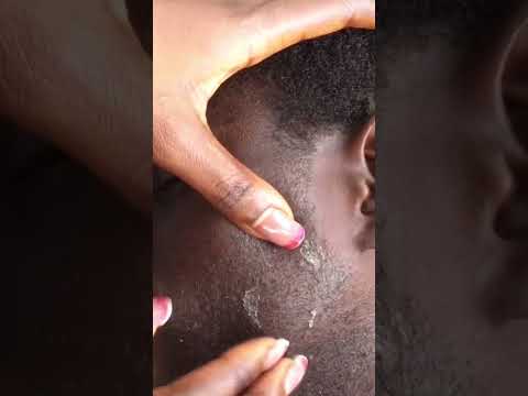 Asmr gentle nitpicking for sleep #tingling #relaxing #satisfying #nitpicking