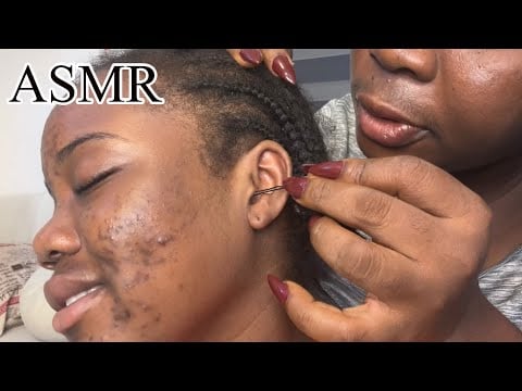 ASMR✨4 Hrs Bobby Pin, Dental Flossing, Pimple Pops, and Deep Ear Cleaning Compilation 