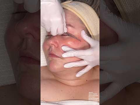 ASMR Dermaplaning