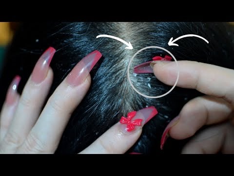 ASMR Scalp Check / Scalp Scratching Big Flakes / Scalp Massage 1 Hour Relaxing For Sleep