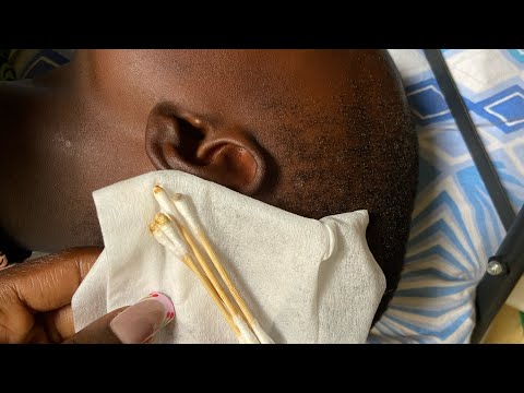 ASMR EAR PICKING & PAMPERING FOR THOSE WHO WANT TO SLEEP