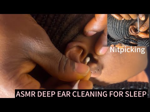 ASMR PROFESSIONAL EAR CLEANING AND PICKING WITH GUM CHEWING FOR SLEEP