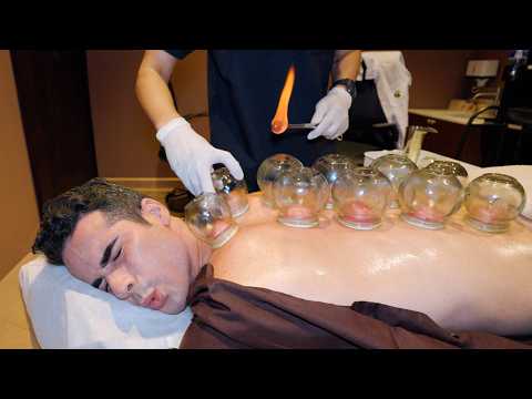 ASMR Cupping & Chinese Tuina Massage - Unocking my Lower Back PAIN