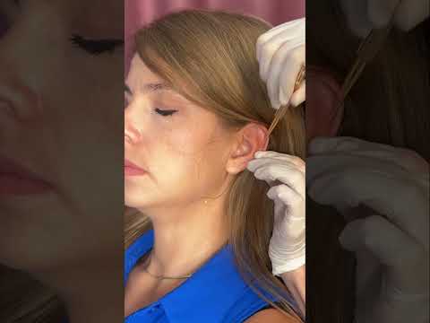 Asmr ear 👂 exam #asmr #relax #relaxing #asmrsounds #asmrvideo #tingles #medical #satisfying #sleep