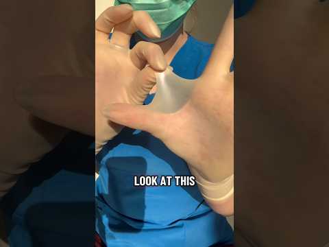 New transparent gloves… the nurse can’t wait to do so many things with them! #medicalexam