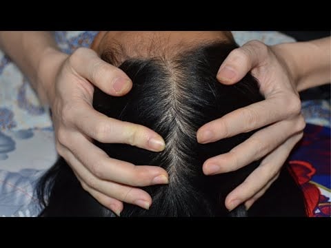 ASMR Real Person Scalp Check, Scalp Massage, Scalp Scratching Relax Make You Feel Asleep