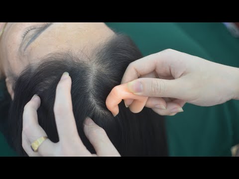 ASMR Hair Parting Real Person, No Talking Scalp Scratch, Scalp Massage Sounds For Relaxation