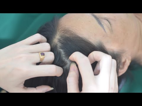 ASMR Aggressive Head Scratching Sounds / No Talking And Focus Hair Sounds For Relaxation