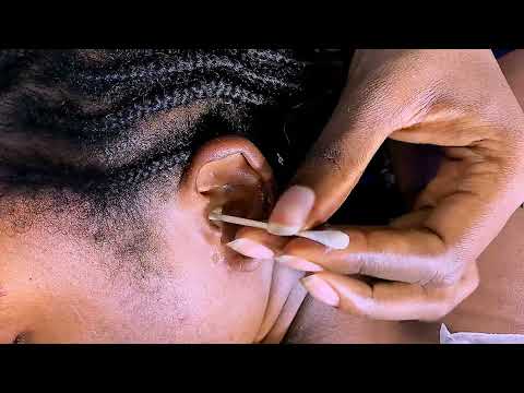ASMR Ear Piercing Cleaning & Dental Flossing Head Massage, Armpit Tickles &  Body Lymphatic Massage