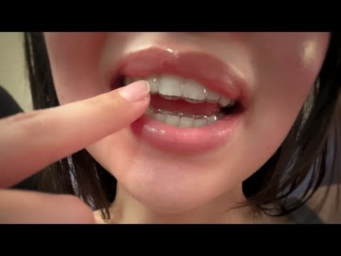asmr ~ with my RETAINER 😬 mouth sounds + teeth tapping 