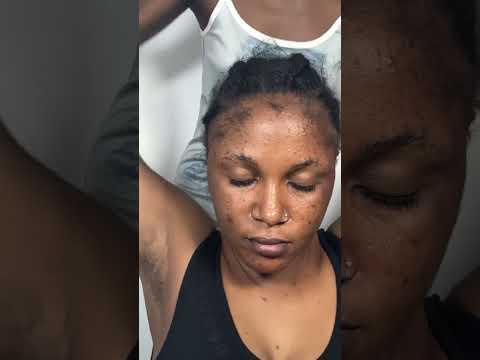 Fast to Slow ASMR Neck & Shoulder Massage, Back Tapping, Scalp Scratching Tingle Overload for Sleep