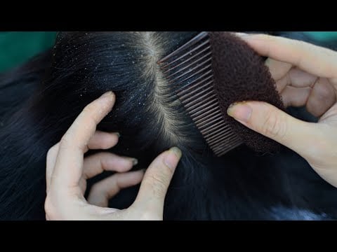 ASMR Scalp Check, Scalp Scratching, Hair Parting, Combing For Relaxation ( No Talking )