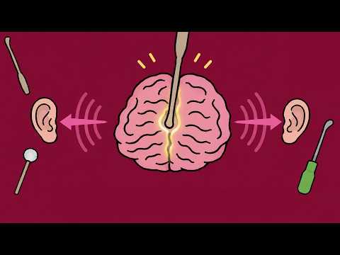 ASMR 뇌주름을 한가닥씩 펴버림ㅋㅋ 관통 귀청소 (노토킹)