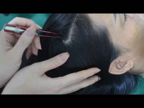 ASMR Aggressive Scalp Scratching, Scalp Massage, Hair Parting On Real Person For Cure Insomnia
