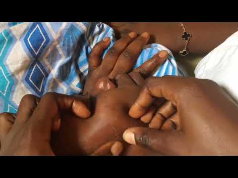 Asmr Nitpicking My Best Friend Face To Sleep/ Best Face Therapy. #asmr