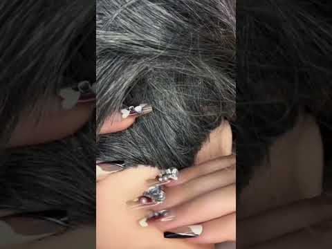 Hairline Scratching 💆🏻‍♀️ #asmr #satisfying #visualtingle #relaxing #mouthwhisper #relax