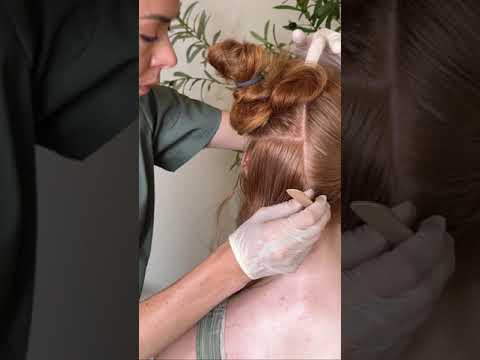 Asmr scalp tingles #asmr #asmrsounds #asmrvideo #relax #relaxing #satisfying #hair #sleep #tingles