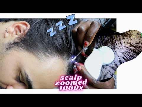 ASMR SUPER ZOOM scalp & lice check extremely satisfying | scratching with a MICROSCOPE