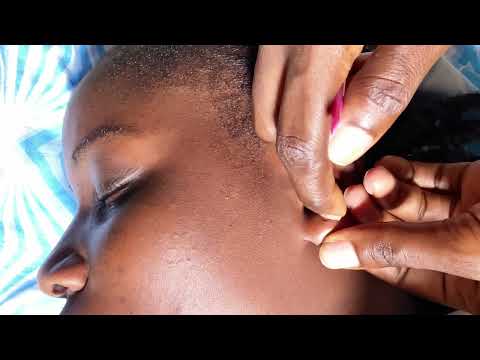 A RARE EAR NIT PICKING FOR SLEEP ASMR