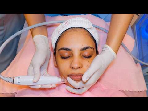 ASMR: Relaxing Hydra Facial Massage with ACNE Removal Treatment for Glowing Skin