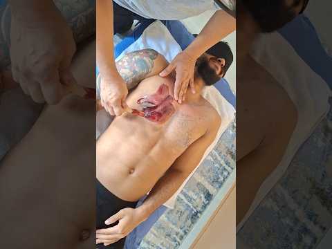 Chest Waxing: Does It Hurt as Much as They Say? | I'll read you in the comments  # #waxingtreatment