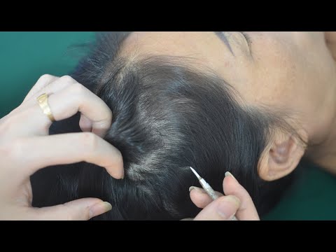 ASMR Real Person Nape Scratch & Hair Combing, Hair Parting No Talking For Anxiety Reduce