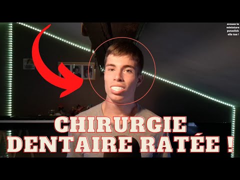 Chirurgie Ratée, Implants, Je Vous Explique Tout ! (en asmr)