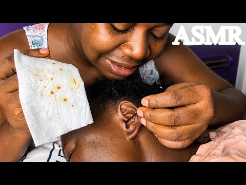ASMR✨Satisfying Bobby Pin Ear Cleaning