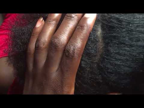 Asmr You will fall asleep in a minute#asmr #dandruff #nitpicking
