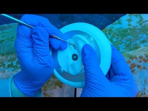 ASMR | Ear Cleaning & Wax Extraction - Limited & Soft Whispers, Spring Tool, Ear To Ear