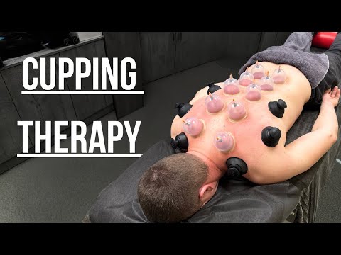 Cupping therapy and back massage | REAL PERSON | MAX ASMR | Deep back massage