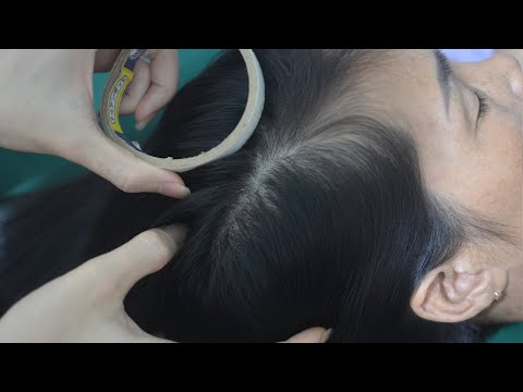 ASMR Nape Scratch No Talking, Real Person Hair Combing, Hair Parting For Anxiety Relief