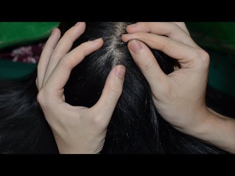 ASMR 1 Hour Scalp Scratching Fast And Aggressive, Scalp Check Real Person Relaxing For Sleep