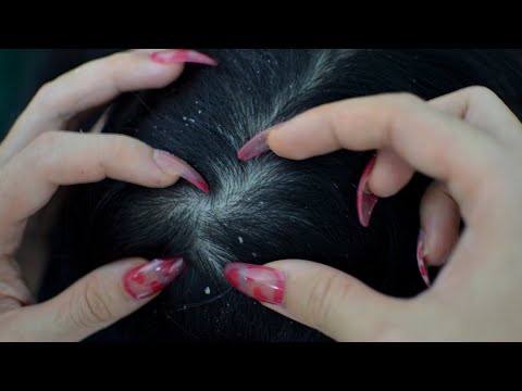 ASMR Scalp Check Real Person, Scalp Scratching With Long Nails For Relaxation ( No Talking Asmr )