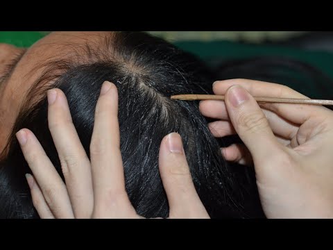ASMR 1 Hour Scalp Check Dry Dandruff Treatment Relaxing For Sleep
