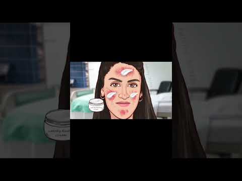 rash treatment animation ASMR || #skintreatment #creator #healing #treatmentanimation #esthetic