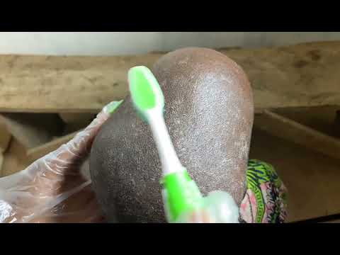 ASMR SCALP CARE | RELAXING DANDRUFF SCRATCHING SOUNDS FOR STRESS RELIEF