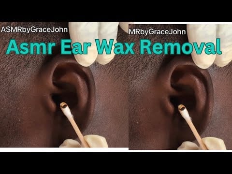 Asmr  Ear Wax Removal | Deep Ear Cleaning For Sound Sleep| #earwaxremoval #earcleaningasmr #asmr