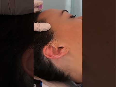 ASMR Ear Exam, Massage, Treatment 🩵 #asmr #asmrrealperson #asmrear #asmrmedical #asmrsounds