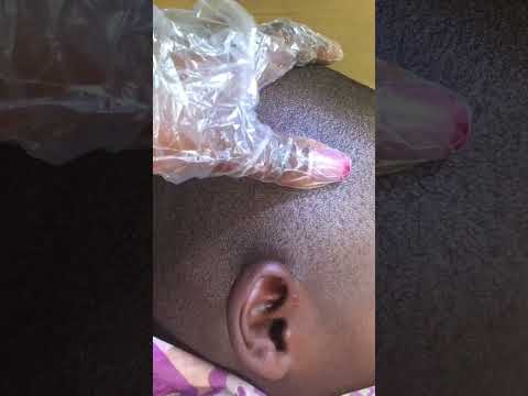 Asmr Ear Cleaning #tingling #satisfying #relaxing #earcleaning