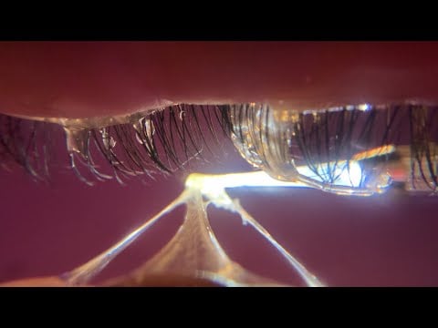 ASMR Eye Cleaning 👁️🧼 with Layered Sounds,Mouth Sounds, & Tingly Visuals