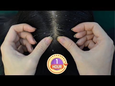 ASMR Scalp Check ~ Scalp Scratching ~ Scalp Massage ~ Scalp Treatment 1 Hour Relaxing For Deep Sleep