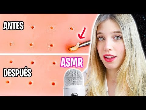 ASMR EXPRIMIENDO ESPINILLAS (MUY SATISFACTORIO Y RELAJANTE)