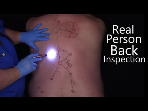 ASMR | Real Person Back Inspection, Mapping, Measuring