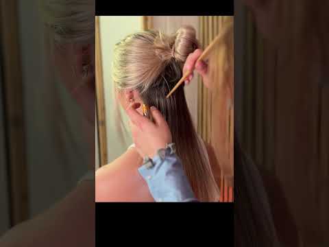 Real person SCALP Exam for Dandruff