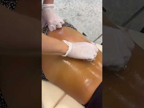 *CRAZY* RIB Head adjustment - #shorts #chiropractic #adjustment