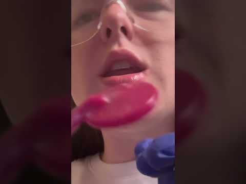Sneak peak at tomorrow’s video 🦷